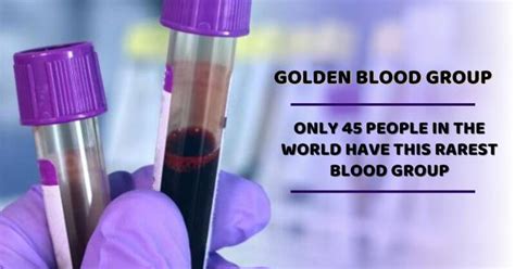 Golden Blood Group: Everything About This Rarest Blood Group In The ...