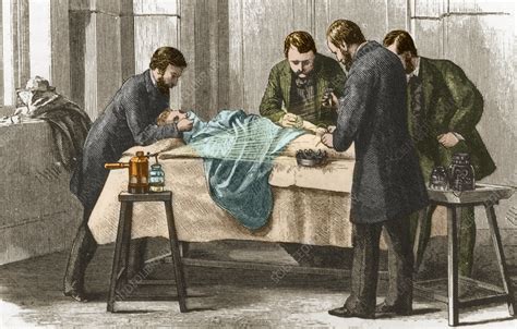 Lister's Antiseptic Spray, Surgery, 19th Century - Stock Image - C030 ...