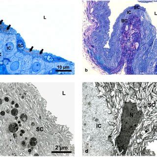 (a) Ultrastructural appearance of lipofuscin granules (arrowheads ...