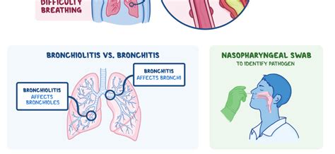 Bronchiolitis – causes, symptoms, treatment, complications – Healthy ...