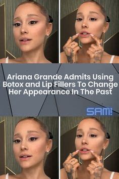 Ariana grande admits using botox and lip fillers to change her appearance in the past – Artofit