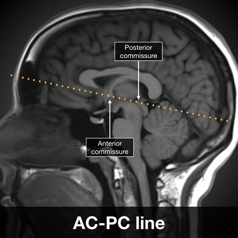 Image | Radiopaedia.org