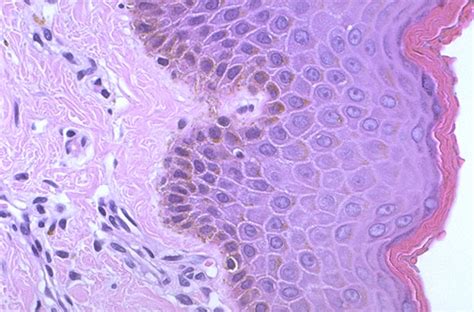 Normal Histology