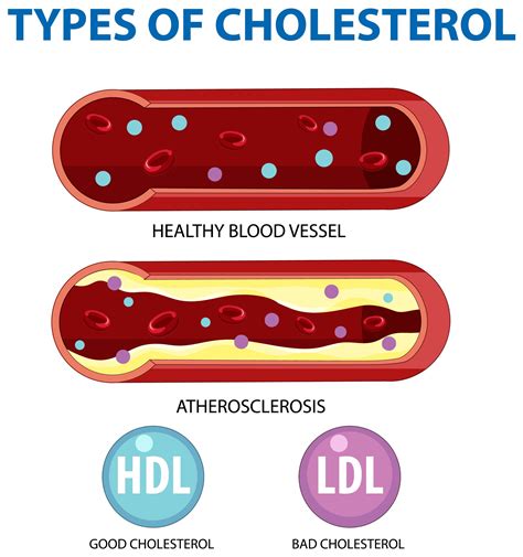 What Foods Lower Ldl Cholesterol Naturally | Deporecipe.co