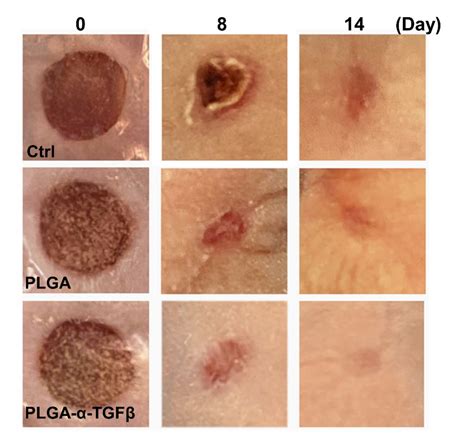 Technology - Novel Material for Skin Wound Closure and Scar Prevention