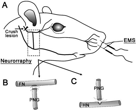 Schematic drawings showing the neurorrhaphy and the EMS procedure. A. A ...