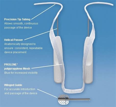 Trial News: J&J TVT-O Mesh Found Defective