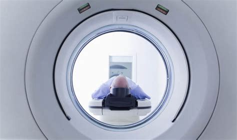 CT scan radiation exposing patients to risk of DNA mutation | Health | Life & Style | Express.co.uk