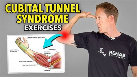 Cubital Tunnel Syndrome, aka Ulnar Nerve Entrapment - Ask Doctor Jo , cubital tunnel ...