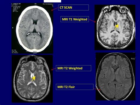 Basics of mri physics Dr. Muhammad Bin Zulfiqar