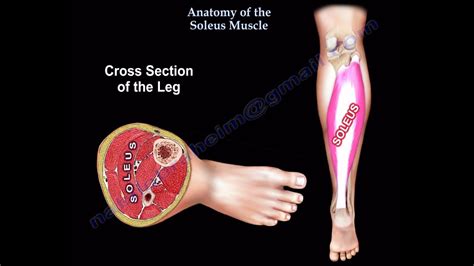 Soleus Muscle Mri