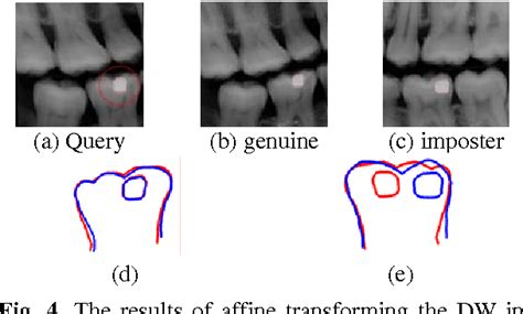 Figure 4 from Dental Identification based on Teeth and Dental Works ...