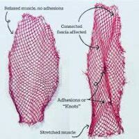 Restricted movement and pain? Fascia and Fascial release - Physiovive