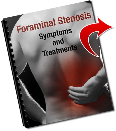 Foraminal Stenosis Treatment