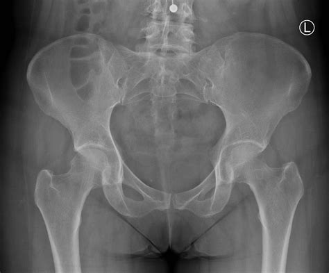 Diagnostics: Knee and Ankle X-rays — Taming the SRU