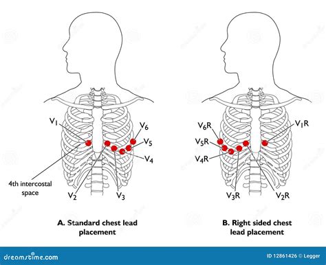 Ecg Diagram And Mean Lead Placement