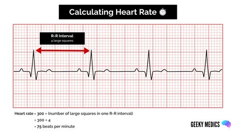 How To Calculate Heart Rate Using 6 Second Method - Haiper