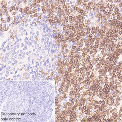 Recombinant Anti-CD3 epsilon antibody [LE-CD3 #3/4] - BSA and Azide ...