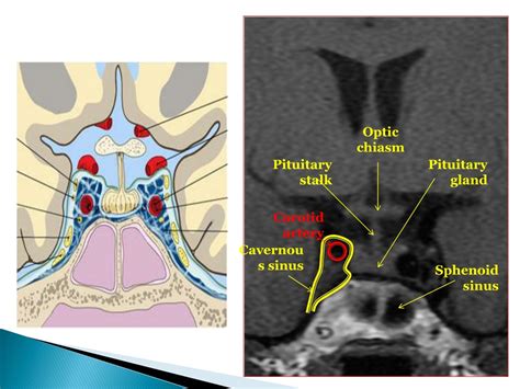 PPT - RADIOLOGY ANATOMY OF THE PITUITARY GLAND PowerPoint Presentation ...