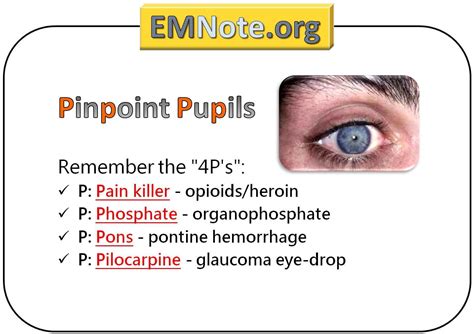 The 4P of pinpoint pupils. : r/physicianassistant