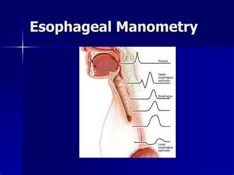 PPT - Esophageal Manometry PowerPoint Presentation, free download - ID ...