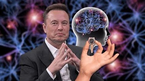 Elon Musk, Neuralink'in beyin çipinin ilk kez bir insana yerleştirildiğini duyurdu