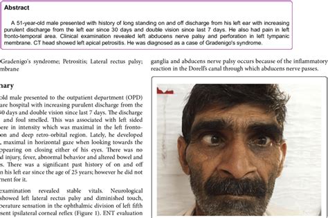 Left lateral rectus palsy. | Download Scientific Diagram