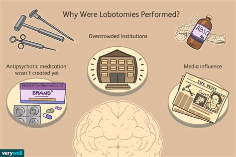 Lobotomy: Definition, History, and Usage