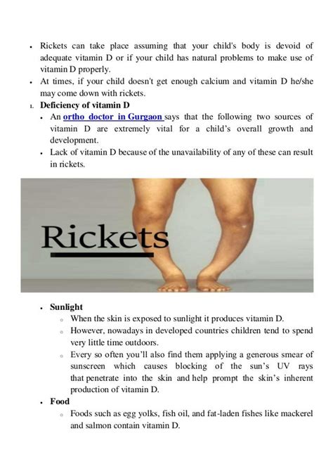 Rickets familiarize yourself with its symptoms and causes