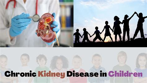 Chronic Kidney Disease In Children | Sprint Medical