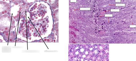 Nephron Histology Diagram | Quizlet