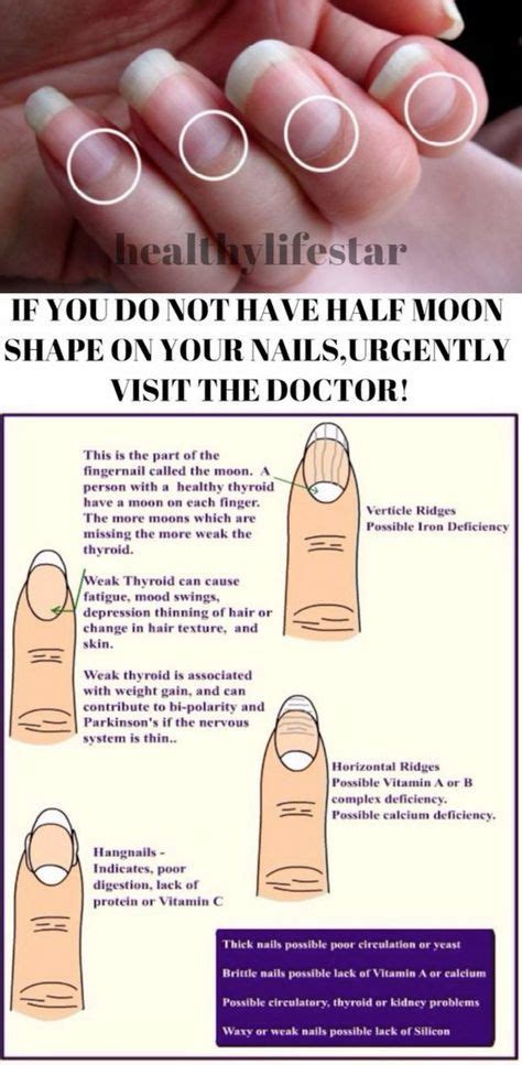 IF YOU DO NOT HAVE HALF MOON SHAPE ON YOUR NAILS,URGENTLY VISIT THE DOCTOR! – Toned