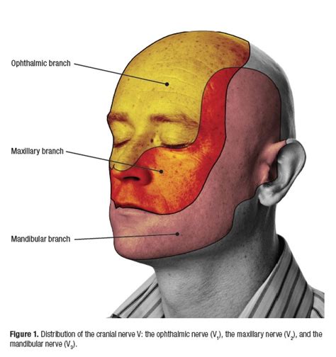 Signs and Symptoms of Trigeminal Neuralgia According to Experts | Nursing 2012