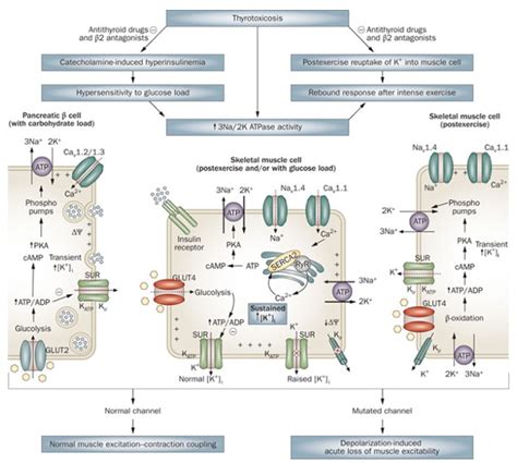 Hypokalemic Periodic Paralysis - Creative Bioarray