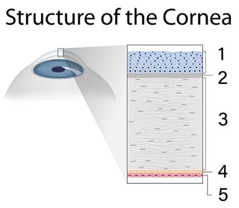 Cornea Poughkeepsie | Cornea Surgery Fishkill | Hudson Valley Eye