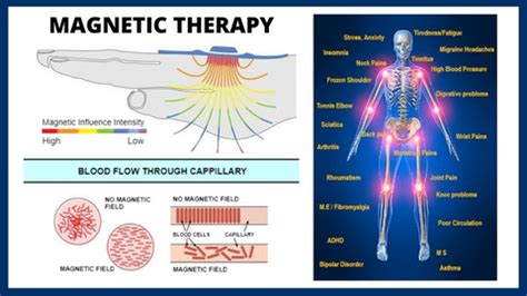 The theory behind magnetic therapy – SABONA