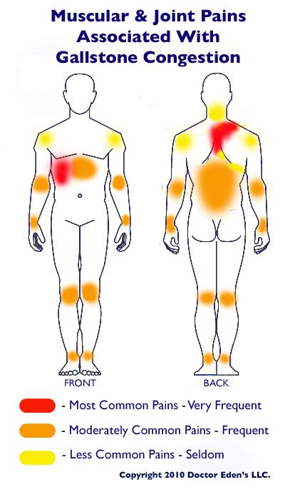 Muscular and Joint Pain Associated With Gallstones - Gallbladder Attack & Gallbladder Pain Treatment