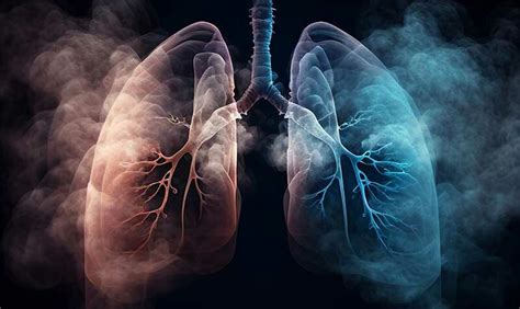 Study reveals how patients' smoking history changes evolution of lung cancer | WEHI