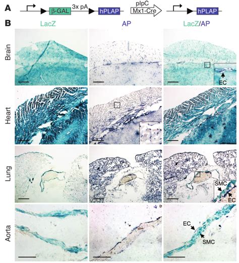 Efficiency of Cre-mediated recombination by induced Mx1-Cre transgene ...