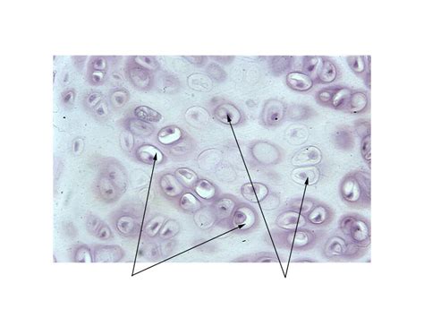 Tracheal Ring (Hyaline Cartilage (400X) Diagram | Quizlet