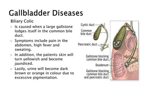 Gallbladder Diseases as related to Turmeric - Pictures