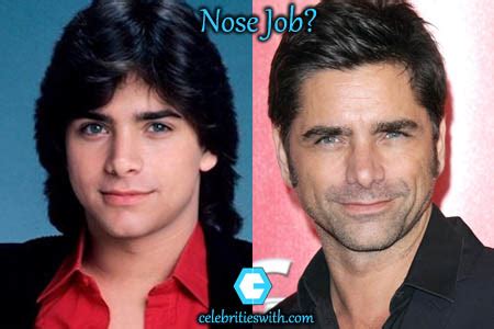 John Stamos Plastic Surgery, Botox, Nose Job, Before and After Pics ...