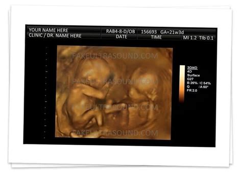 3d Twins Gender Reveal Ultrasound - Fake Ultrasound