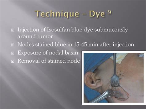 Sentinel lymph node biopsy - orthopadi