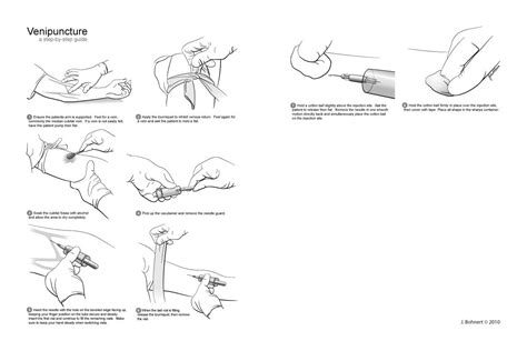 Venipuncture Sites Diagram