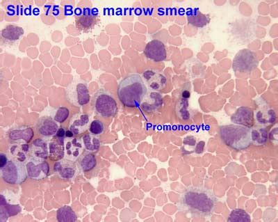 Promonocyte - Wikiwand