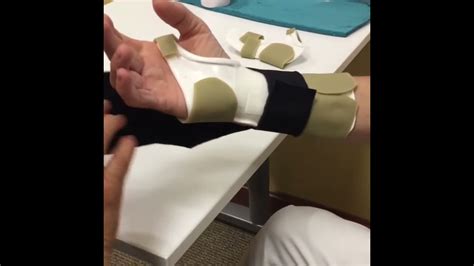 Dynamic composite finger flexion splint - YouTube