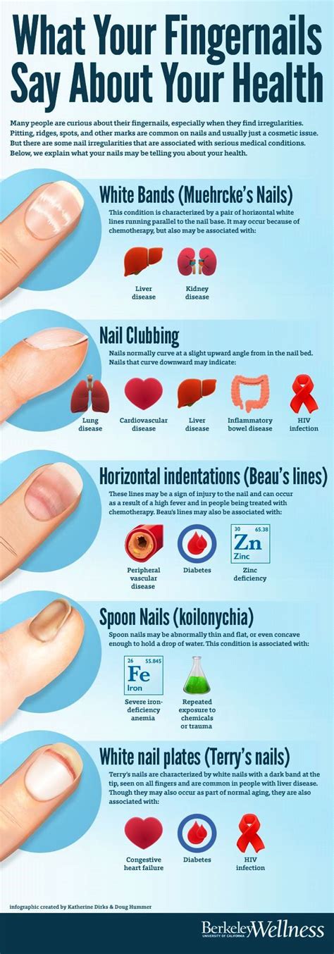 The 25+ best Ridges on nails ideas on Pinterest | Vitamin b deficiency ...