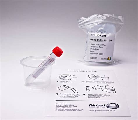 Primary urine collection kit with boric acid