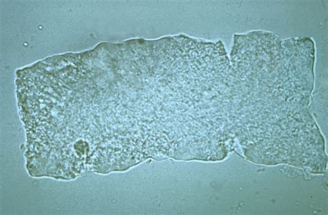 Urinalysis